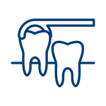 Tooth Extraction