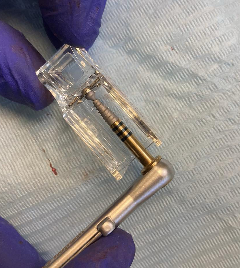 The implant before its placement