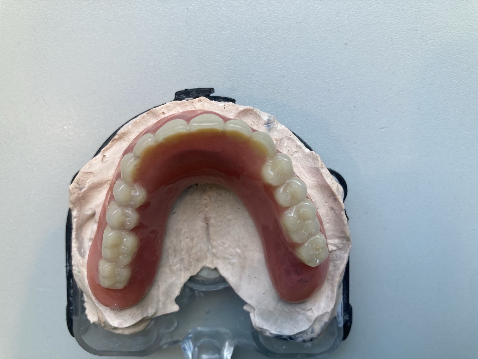 The finished construction, attached to the implant The finished construction, attached to the implant